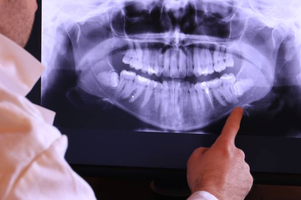 Best Emergency Treatment for Oral Infections in Lame Deer, MT