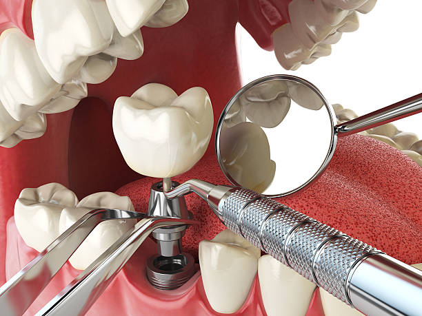 Best Emergency Treatment for Oral Infections in Lame Deer, MT